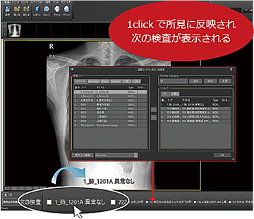 PACSPLUS SCREEN Viewer(Tele Version)/ ツールバー設定機能(読影コード追加登録)