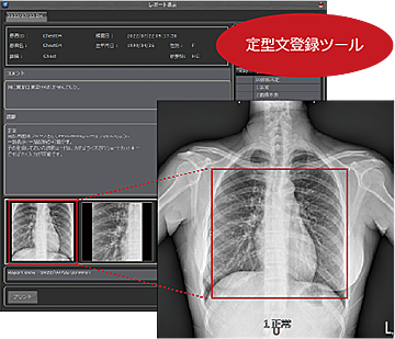 PACSPLUS SCREEN Viewer(Tele Version)/ 検査結果(レポート機能)